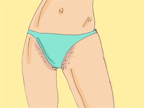 Heat Rash Bikini Line