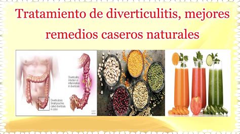 Tratamiento De Diverticulitis Mejores Remedios Caseros Naturales Youtube