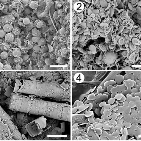 Scanning Electron Micrographs Of Untreated Rock Fragments From Four