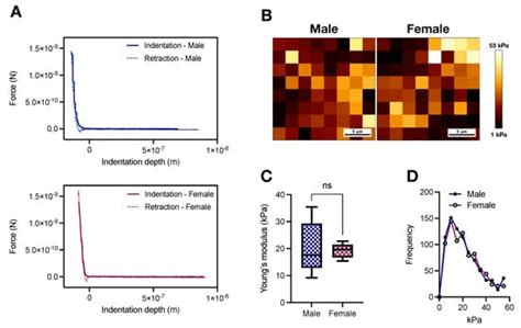 Connecting Aortic Stiffness To Vascular Contraction Does Sex Matter