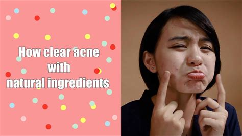 Tips How To Clear Acne With Natural Ingredient Youtube