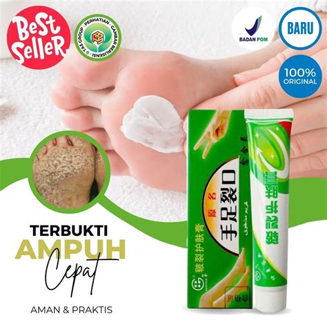 Jual Pembersih Tumit Kaki Pecah Salep Kutu Air Obat Kaki Pecah Pecah