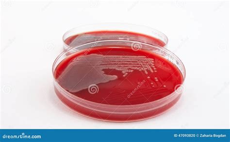 Pseudomonas Aeruginosa Bacteria On On Columbia Blood Agar Stock Photo ... 