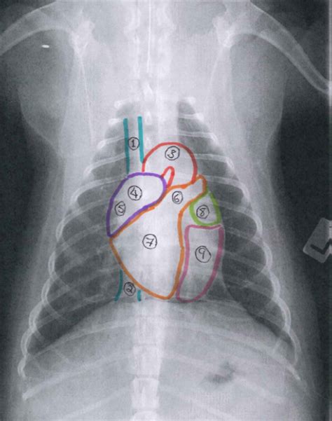 Label Heart Of Dorsoventral Thoracic Radiograph Diagram Quizlet