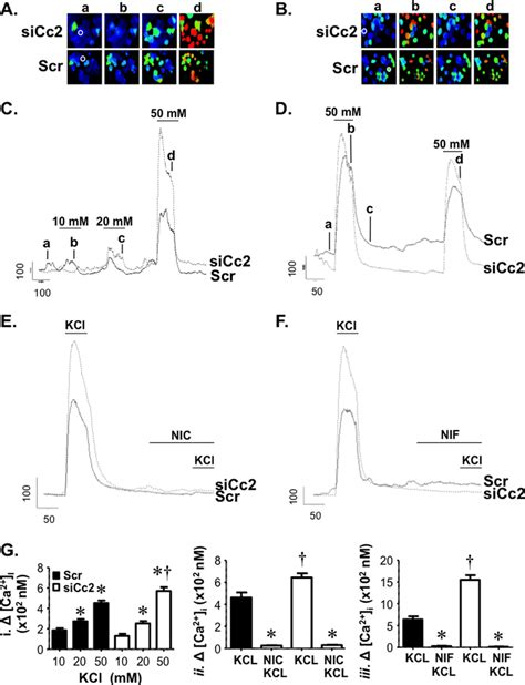 Ceacam Regulates Glp Secretion Through L Type Voltage Dependent Ca