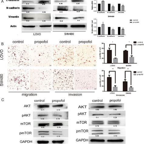 Propofol Inhibits EMT Of Colon Cancer Cells And PI3K AKT MTOR