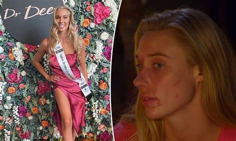Australian Survivor star Sarah Marschke's past scandal revealed | Daily ...