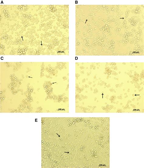 Entamoeba Histolytica Slide