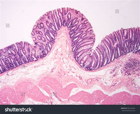 Histology Colon Human Tissue Show Epithelium Stock Photo 666105634