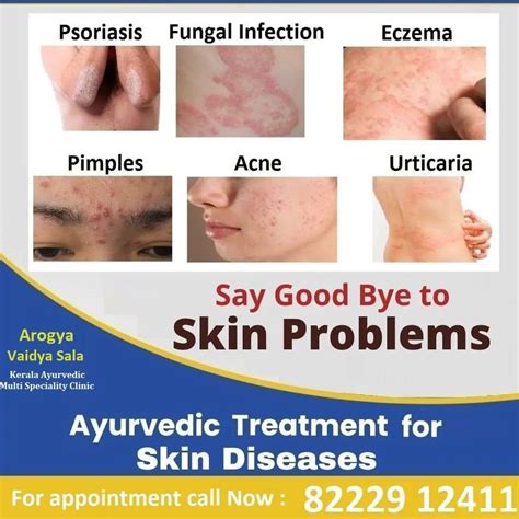 Arogya Vaidya Sala — Cure Skin Allergy With Effective Kerala Ayurvedic