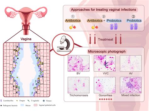 Lactobacilli Probiotic Strains Adhered To Vaginal Epithelium Cells As My XXX Hot Girl
