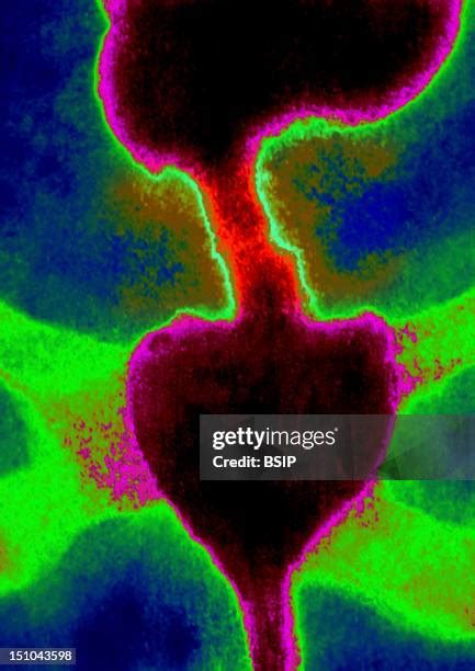 Rectal Exam Photos And Premium High Res Pictures Getty Images