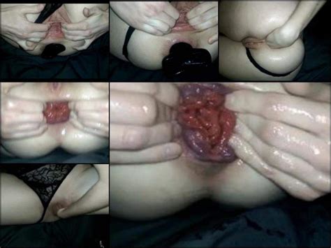 First Big Dildo Rare Home Anus Fisting And Prolapse Ass Stretched Wife