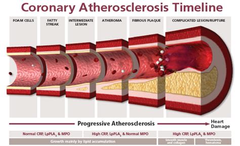 Inflammation