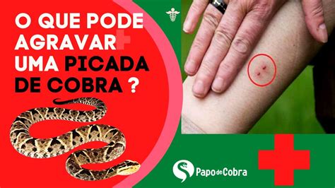 Cuidado Isso Pode Fazer Uma Picada De Cobra Ficar Bem Grave Papo