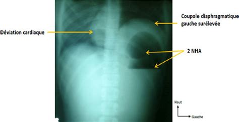 radiographie de labdomen sans préparation Download Scientific Diagram