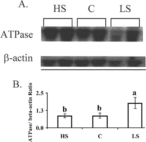 Representative Northern Blot Analysis Of Na K Atpase In The Jejunum