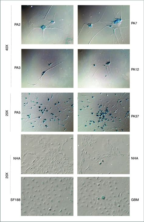 Sa B Gal Activity Is Increased In Primary Pas Six Fresh Tissue Samples