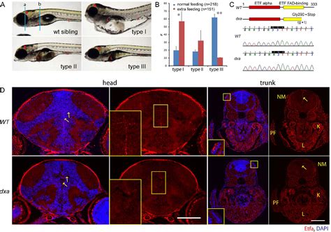 Figure 1 From Multi Organ Abnormalities And Mtorc1 Activation In