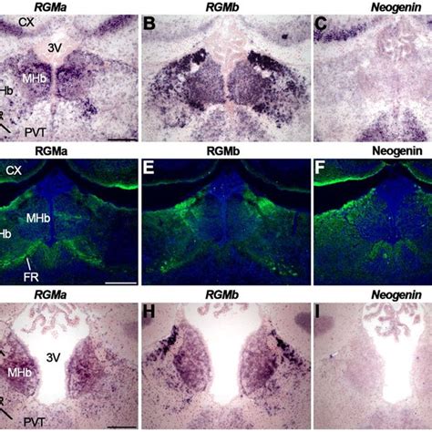 In Situ Hybridization On Coronal Mouse Brain Sections At E16 5 AD