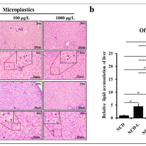 Histological Analysis Of The Liver Of Pups A Hande Staining Of The Download Scientific Diagram