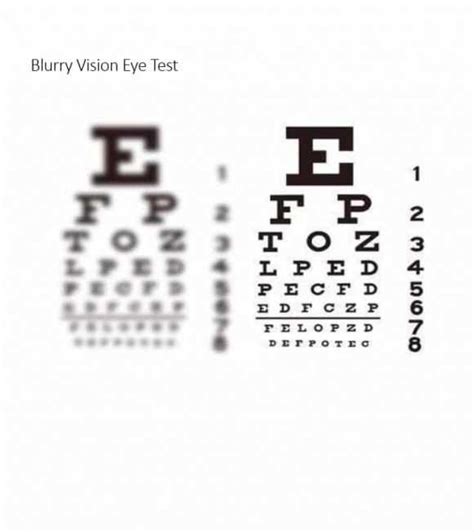 The Importance of Eye Exam Charts for Passing the DMV Test