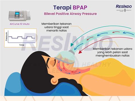 Cara Kerja Mesin Bipap Resindo Medika