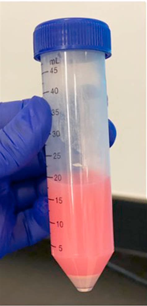 Figure 1 From A Protocol For Isolation Of Primary Human Immune Cells