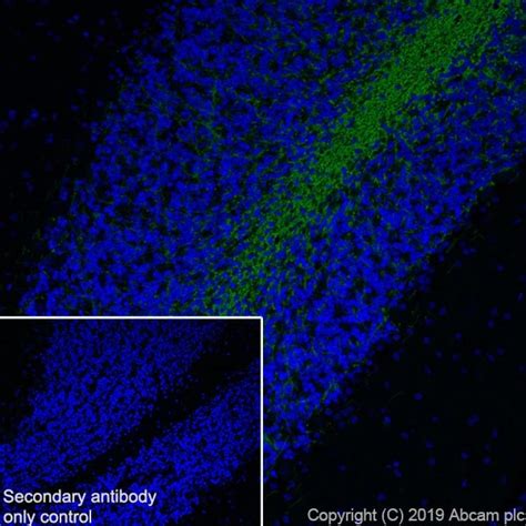 Oligodendrocyte markers | Abcam