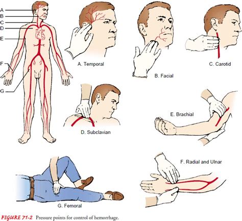 Hemorrhage Emergency Nursing