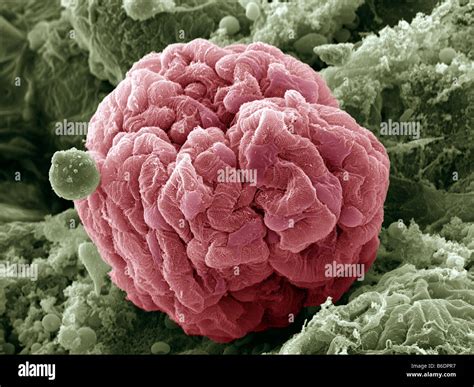 Kidney Glomerulus Coloured Scanning Electron Micrograph Sem