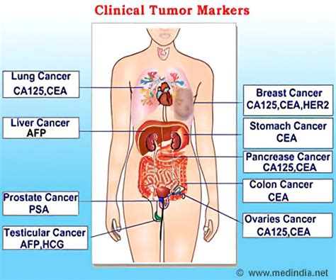 Tumor Markers For Cancer Diagnosis And Prognosis