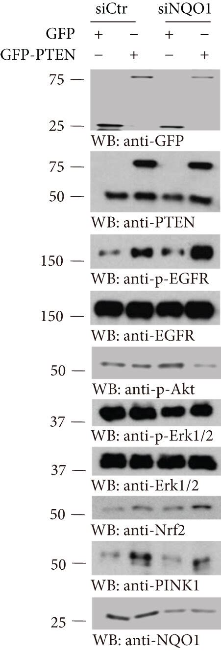 Pten Upregulates Nqo1 Expression And Inhibits Cell Proliferation Of