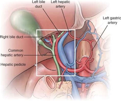 High Malignant Biliary Tract Obstruction Basicmedical Key