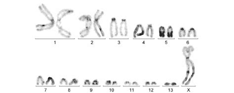 Caryotype En Bandes C De Saga Rammei Mâle La Paire N°5 Porte Un Grand