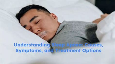 Ppt Understanding Sleep Apnea Causes Symptoms And Treatment