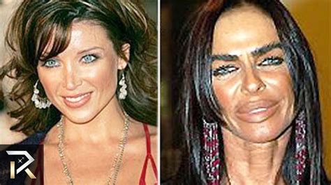 10 Plastic Surgery Cases That Went Too Far Bad Celebrity Plastic Surgery Plastic Surgery Fail