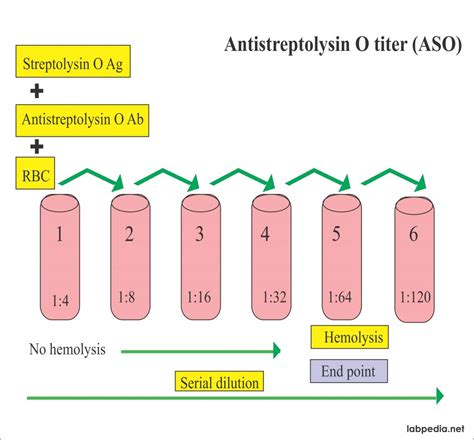 Estreptolisina O Aslo - Anti Estreptolisina O - Aslo - RETOEDU