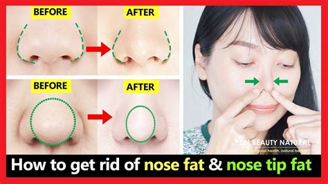 4 Best Exercises Get Rid Of Nose Fat Nose Tip Fat Bulbous Nose Tip Slim Down Fat Nose