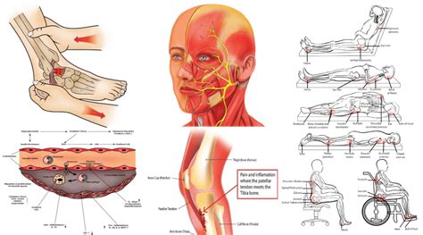 Medical Illustration Services | Medical Illustration Service