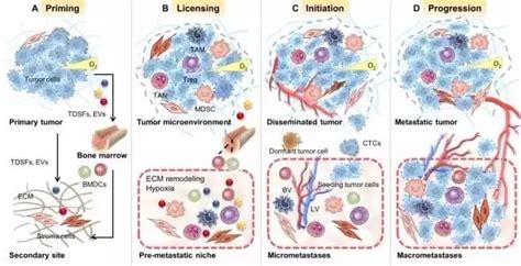 肿瘤转移前微环境的特征与作用 知乎