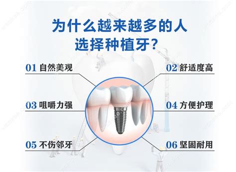 西昌牙科收费标准2023，西昌种植牙1718一颗 拔智齿380 补牙98 口腔资讯 牙齿矫正网