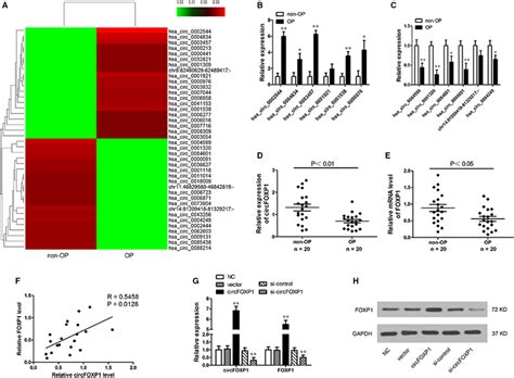 CircRNA Expression Profiles In OP Patients A Cluster Heat Map For Top