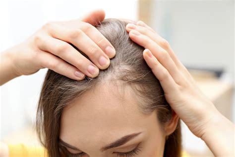 How To Stop Alopecia Areata From Spreading With The Help Of Right