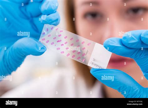 Technician In The Lab Preparing Slides Tissues For Microscope Stock