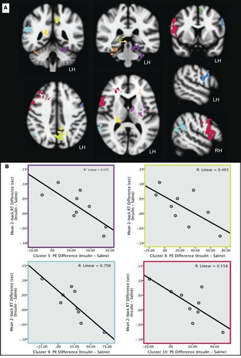 Jci Insight Task Related Fmri Bold Response To Hyperinsulinemia In