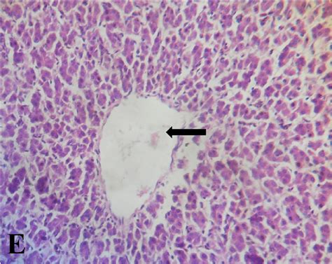 Photomicrograph Of The Liver From Normal Control Chicken Group Showing