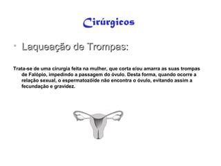 Métodos contraceptivos humanos | PPT