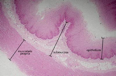 Stratified Squamous Epithelium Non Keratinized Esophagus