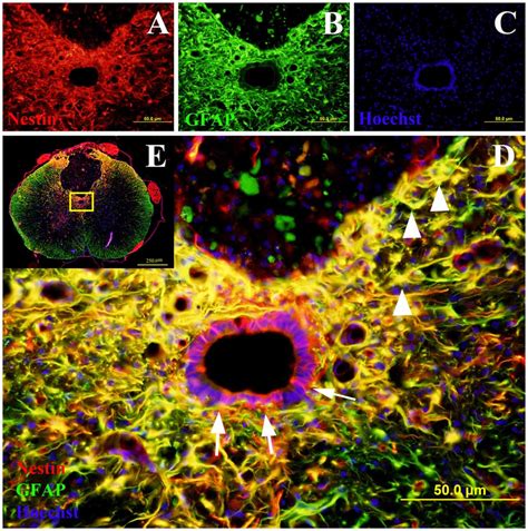 Co Labeling Of Nestin And Glial Fibrillary Acidic Protein GFAP In Rat